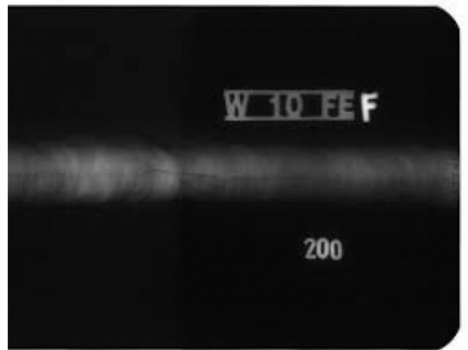 Röntgenfilme und industrielle Radiographie Neusohl - Foto 1